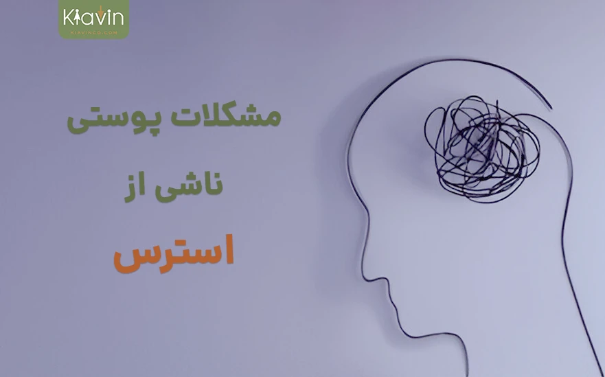 آسیب های استرس بر سلامت پوست