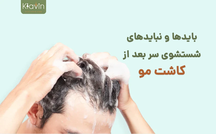 نحوه شستشتو و مراقبت از موهای کاشته شده