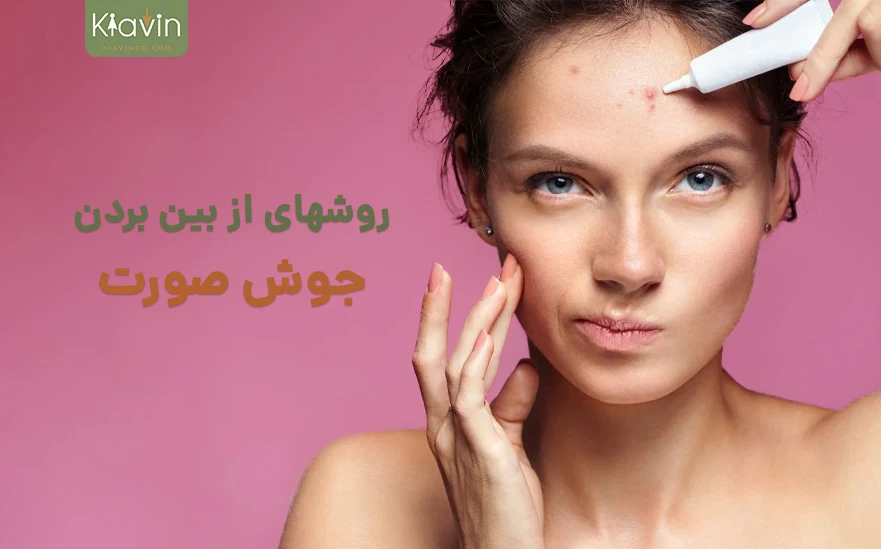 رفع جوش صورت در خانه