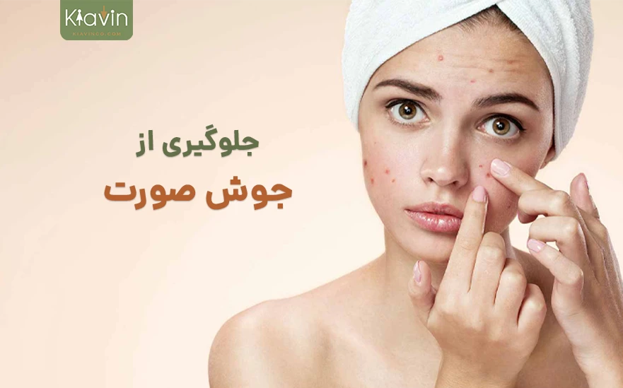 روشهایی برای پیشگیری از ایجاد جوش صورت