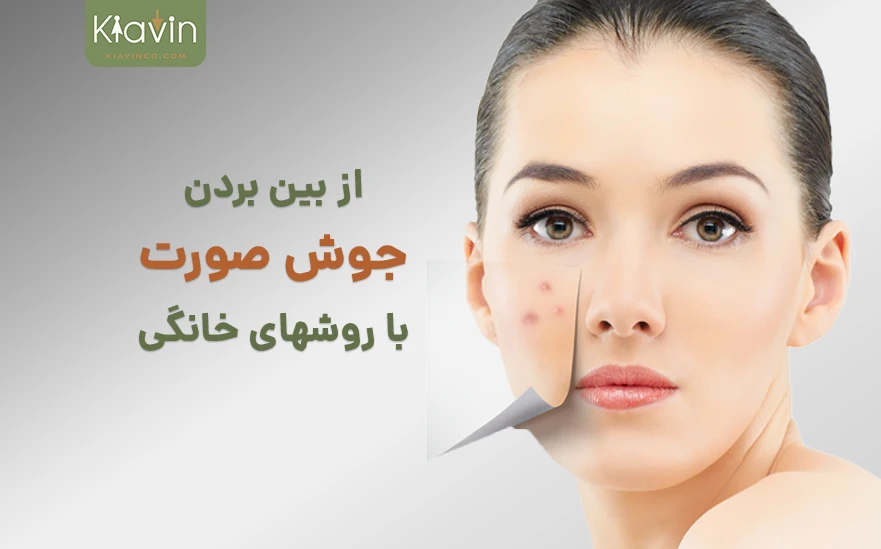 علت جوش صورت و روشهای از بین بردن آن